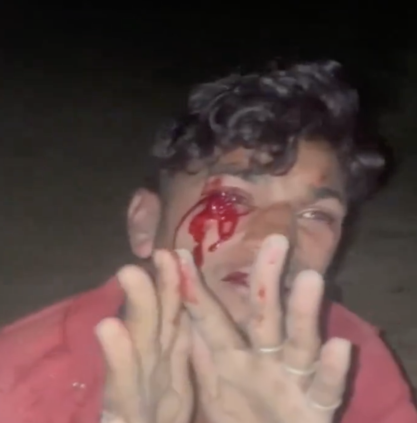 Cow vigilantes brutally thrashed two men for transporting cattle in Jaipur