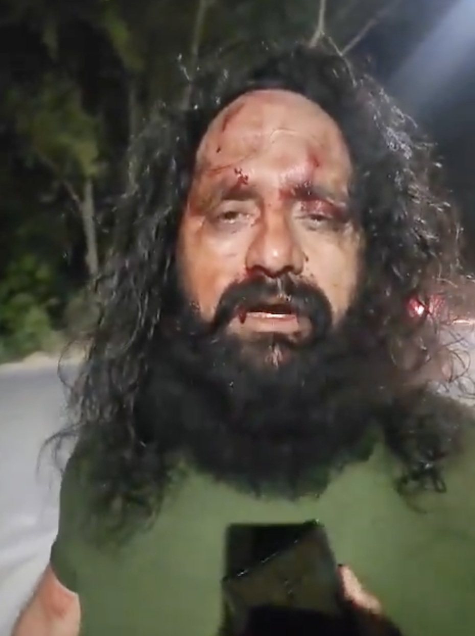 Sikh Man thrashed after called “Khalistani”