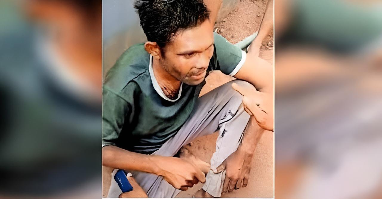 “10,000 autopsies, never saw this violence; no part of body untouched”: Doctor on Dalit migrant lynching in Kerala; accused linked with BJP–RSS (Maktoob Media)