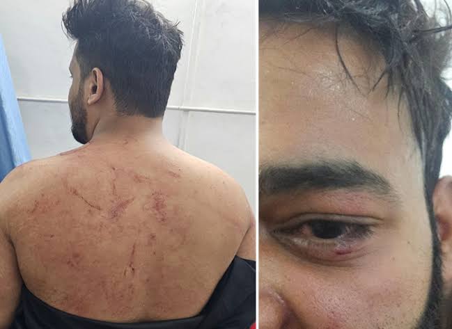 “Remove your skull caps”: Mob attacks Muslims gathered for iftar near Pune lake, 11 injured (Maktoob Media)