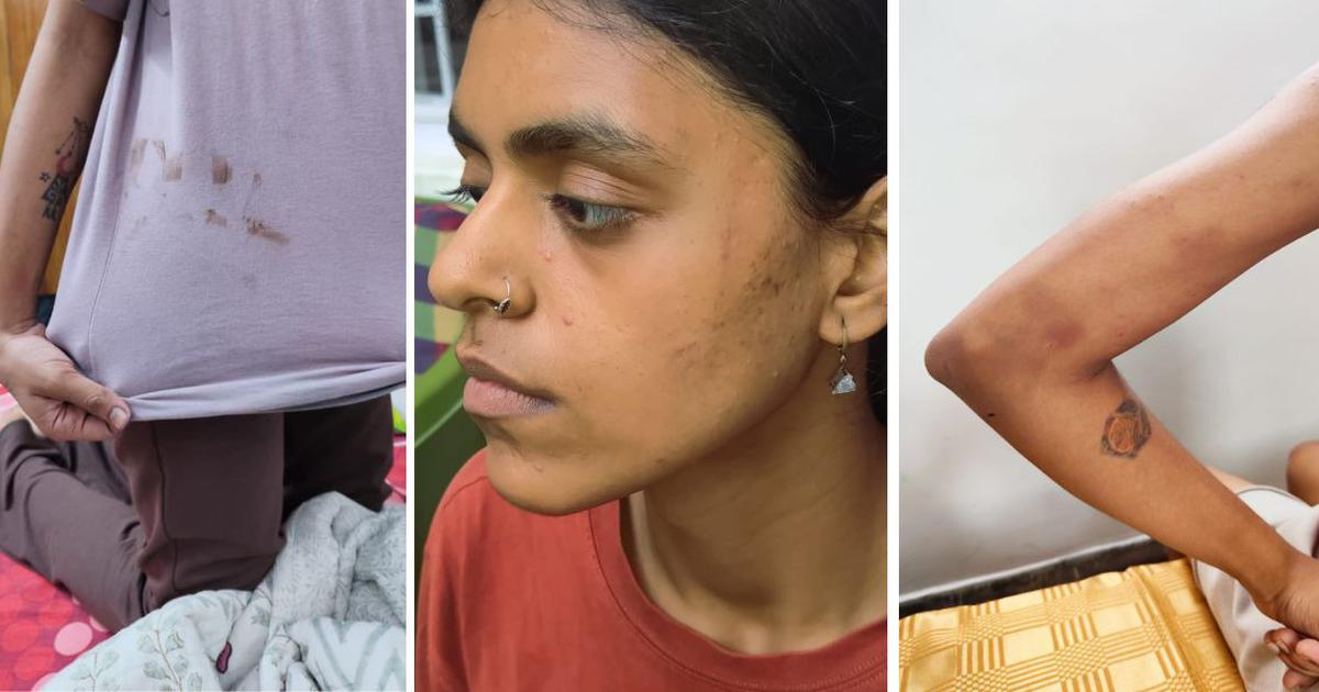 ‘Private parts kicked, phones taken away’: Detained Delhi protestors allege assault in police vans (Scroll)
